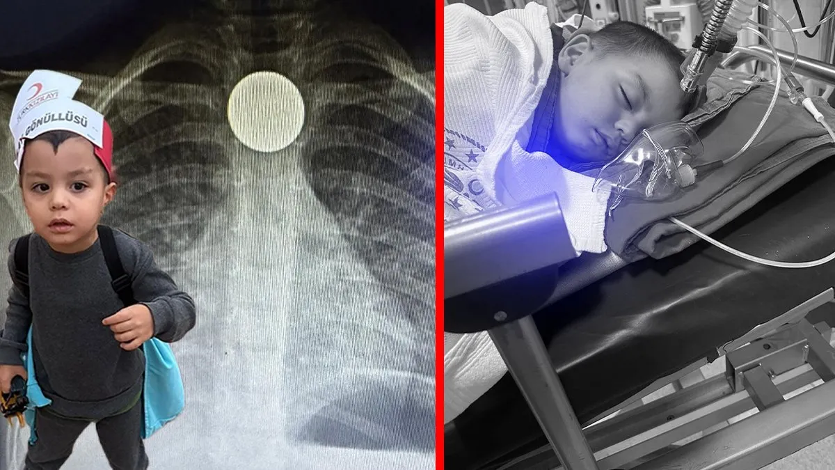 3 yaşındaki çocuğun ağzına attığı para boğazında kaldı: O şekilde kalmasa canından oluyordu!