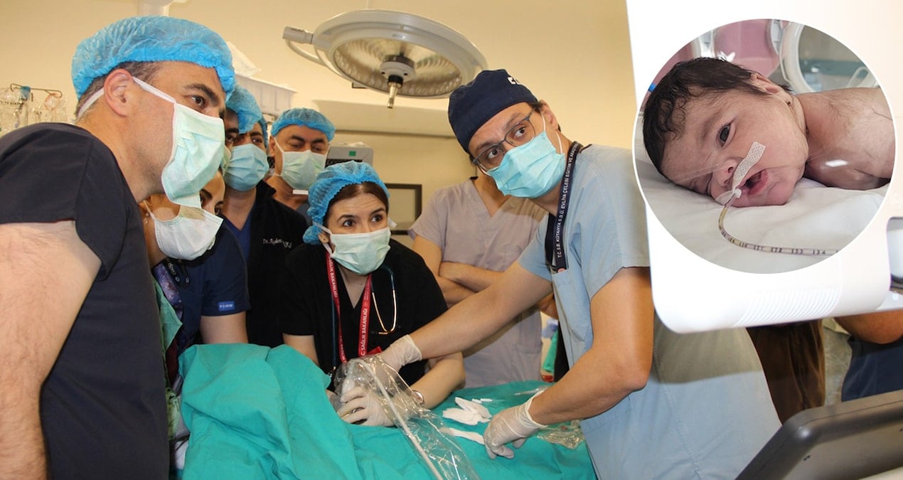 Tıp tarihine geçecek operasyon: 3 kilo bebekten yarım kilo tümor çıktı